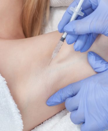 The doctor makes intramuscular injections of botulinum toxin in the underarm area