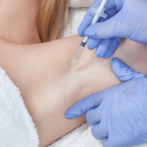 The doctor makes intramuscular injections of botulinum toxin in the underarm area